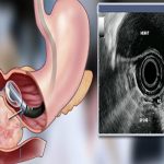 داورنیا: بیمارستان امام خمینی (ره) اردبیل به اندوسونوگرافی
مجهز شد_6919c30992149.jpeg