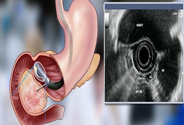 داورنیا: بیمارستان امام خمینی (ره) اردبیل به اندوسونوگرافی
مجهز شد_6919c30992149.jpeg