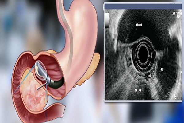داورنیا: بیمارستان امام خمینی (ره) اردبیل به اندوسونوگرافی
مجهز شد_6919c30992149.jpeg